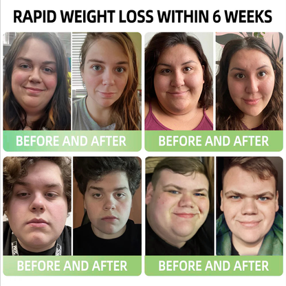 𝑷𝑬𝑨𝑹𝑳𝑴𝑶𝑶𝐍® 𝑰𝒄𝒆 𝑺𝒊𝒍𝒌 𝑰𝒐𝒏-𝑭𝒊𝒃𝒆𝒓 𝑹𝒆𝒑𝒂𝒊𝒓 𝑺𝒉𝒂𝒑𝒊𝒏𝒈 𝑺𝒉𝒐𝐫𝐭𝐬 👨‍⚕️👨‍⚕️𝐅𝐚𝐭 𝐛𝐮𝐫𝐧𝐢𝐧𝐠, 𝐬𝐤𝐢𝐧 𝐭𝐢𝐠𝐡𝐭𝐞𝐧𝐢𝐧𝐠, 𝐩𝐫𝐨𝐦𝐨𝐭𝐢𝐧𝐠 𝐜𝐢𝐫𝐜𝐮𝐥𝐚𝐭𝐢𝐨𝐧 & 𝐥𝐲𝐦𝐩𝐡𝐚𝐭𝐢𝐜 𝐝𝐫𝐚𝐢𝐧𝐚𝐠𝐞 𝐟𝐨𝐫 𝐡𝐨𝐥𝐢𝐬𝐭𝐢𝐜 𝐡𝐞𝐚𝐥𝐭𝐡